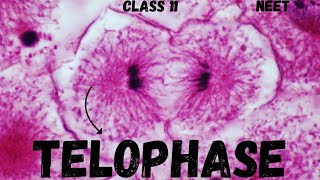 NEET CELL CYCLE AND CELL DIVISION  TELOPHASE  CLASS 11 neet ncert youtube youtubeshorts [upl. by Mccarthy]