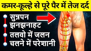 कमरकूल्हे से पूरे पैर में तेज दर्द का इलाज  Serious Leg Pain AVN Pain Relief and Treatment [upl. by Coryden]