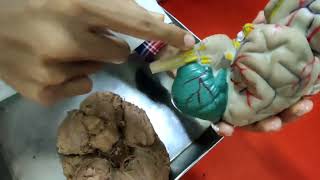 Cerebrum Viscera Bangla Demonstration  Brain Anatomy Bangla  Base Of The Brain [upl. by Ultima755]