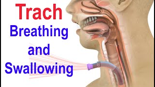 Trach Breathing and Swallowing [upl. by Eninnej]