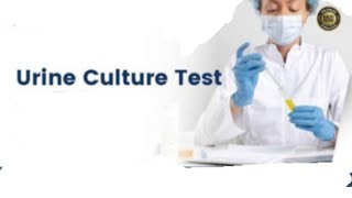 Urine Culture Test for UTI [upl. by Duwe]