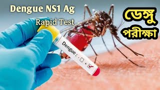 Dengue Rapid Test  NS1 Antigen test for Dengue  Creative Zone Plus [upl. by Chelsae393]