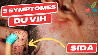 VIH ou SIDA  les symptomes du VIH  dépistage de VIH [upl. by Ise]