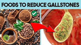 quotManaging Gallstones with Diet Best Foods to Eatquot Foods To Reduce Gallstones  Fourth Panda [upl. by Fleurette520]