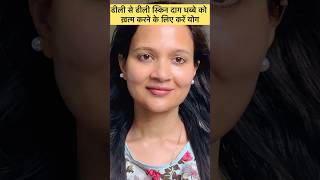 Face yoga for AntiAging Glowing Skin WRINKLES चेहरे की झुर्रियों के लिए करें योग shortvideo [upl. by Baldridge]