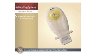 ColostomyIleostomy Pouching Systems [upl. by Navonod]