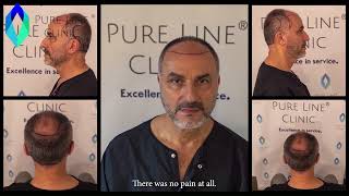 Hair Transplant in Turkey I Matthew from New York USA I The Pure Line Clinic ® Experience [upl. by Joachim]