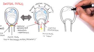 Obstetrics  Stage I of Labour [upl. by Bywoods]