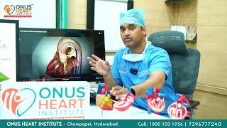 Revolutionizing Heart Valve Care Dr Lakkireddy on Advanced TAVI Procedure at Onus Heart Institute [upl. by Collins]