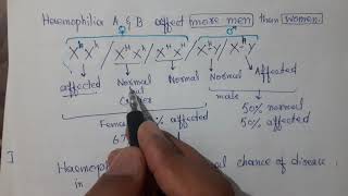 Genetics of Haemophilia  X Linked RecessiveTrait  Pedigree  Failure of Blood Clot [upl. by Neelehtak]