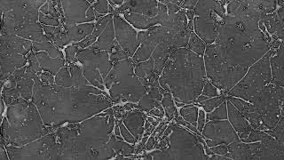 Neurite network formation [upl. by Euqinehs526]