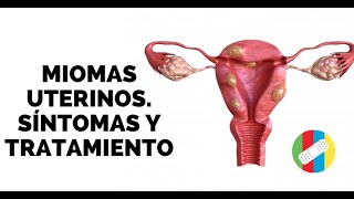 MIOMAS UTERINOS Síntomas y Tratamiento [upl. by Aokek]