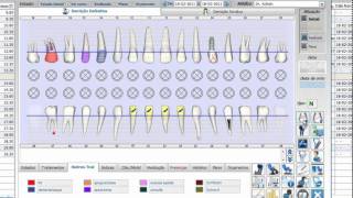 Odontograma  Newsoft DS 11 [upl. by Ahsinit810]