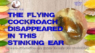 The flying cockroach disappeared in this stinking ear 119 [upl. by Buck]