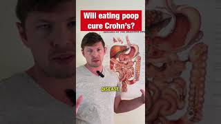 Eating POOP Magic Cure For Crohns Disease [upl. by Kenric]