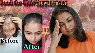 Food for faster hair growth  Hair growth Diet [upl. by Chaudoin593]