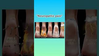 NEUROPATHIC PAIN health [upl. by Cirnek434]