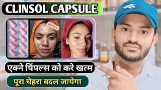 Clinsol capsule uses in hindi how to take clinsol capsule full review in hindi [upl. by Leighton]