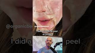 Reacting to this chemical peel thats done at home 🫣 credit organicbeautylover on TT [upl. by Holds]