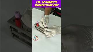 ESR Practical ll ESR viral shorts [upl. by Eilsel]