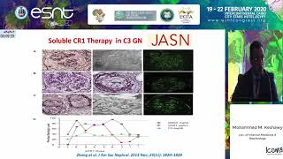 C3 glomerulopathy update [upl. by Ybhsa117]