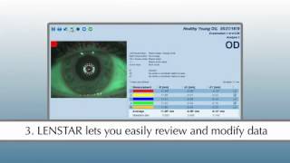 HaagStreit LENSTAR Instant White to White Measurement Tutorial [upl. by Einneg]