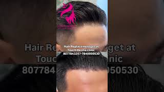 Hair Replacementget Superb Quality Natural Human Hair at Touch Derma clinicus80778432577840050530 [upl. by Ahsiym]