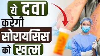 Psoriasis Ki Dava  Best Medicine For Psoriasis In India  सोरायसिस के लिए कौन सी दवा ले [upl. by Charleen]