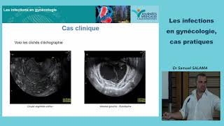 Les infections en gynécologie cas pratiques [upl. by Maxwell]