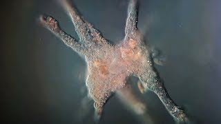 How dangerous are braineating Amoeba [upl. by Annoj879]