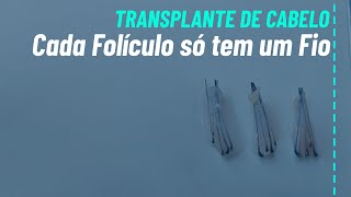 A Ciência por Trás dos Folículos Capilares no transplante capilar [upl. by Alain]