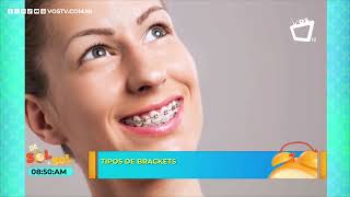 Tipos de brackets Estos son los mejores [upl. by Roswell]