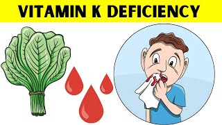 The Surprising Truth About Vitamin K Nobody Tells You [upl. by Theresita]