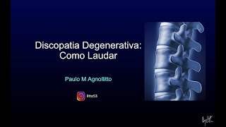 DISCOPATIA DEGENERATIVA COMO LAUDAR [upl. by Enybor]