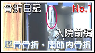 【骨折日記No1】≪入院前編≫仕事中にはしごから転落して足を骨折した！ [upl. by Ty]