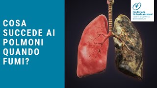 Come sono i polmoni di un fumatore Cosa succede ai tuoi polmoni quando fumi [upl. by Prima]