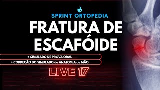 LIVE 17 FRATURA DE ESCAFÓIDE [upl. by Nazar]