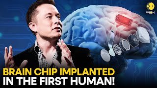 Elon Musks Neuralink implants brain chip in human for the first time  WION Originals [upl. by Vasili241]