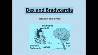 Dexmedetomidine A to Z by dr tushar chokshi [upl. by Dita]