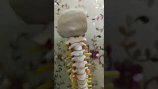 Cervical pain treatment  disk bulge  MCG Technique by Dr Veeresh Kumar [upl. by Masson]