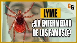 Enfermedad de Lyme  ¿La Enfermedad de los Famosos  Fisiopatología Síntomas y Controversia [upl. by Yahska31]