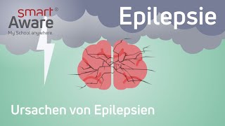 Epilepsie Ursachen von Epilepsien  Fachfortbildungen Pflege  Fortbildung Pflege  smartAware [upl. by Sheppard]