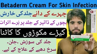 Betaderm N Cream  Neomycine  Betamehasone  Treatment Of Skin Infecions EczemaRashesDermatitis [upl. by Nnyrb702]