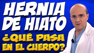 HERNIA DE HIATO  ¿Qué pasa dentro del cuerpo de las personas que la padecen [upl. by Rehpotsirhcnhoj]