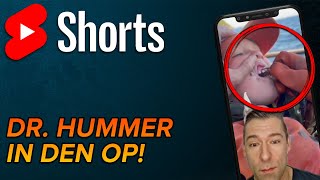 Hummerschere zum Milchzahn ziehen shorts [upl. by Eemla198]