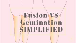 Fusion VS Gemination SIMPLIFIED [upl. by Ainavi695]