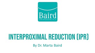 Interproximal Reduction IPR at Baird Orthodontics [upl. by Sivek]