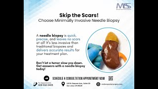 Needle Biopsy Skip The Scars [upl. by Moll]