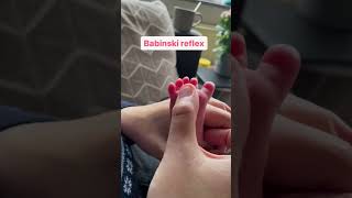 Babinski Reflex psychology [upl. by Okika]