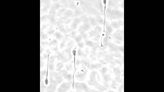 Axon growth cone of primary rat hippocampal neurons on Motility CYTOOchips [upl. by Sgninnej312]